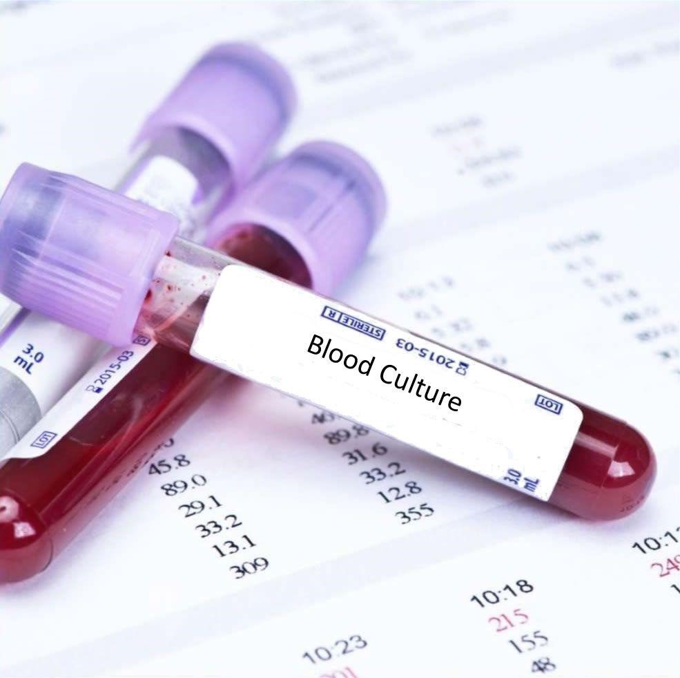 Blood-Culture-Tests-Market