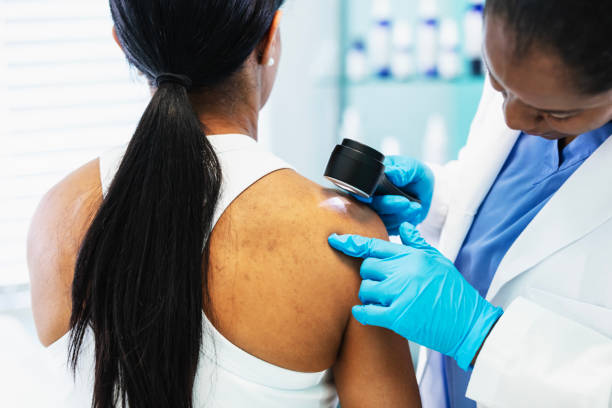 melanoma treatment Costa Mesa CA