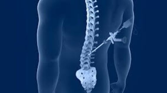 Minimally Invasive Spine Surgery India Expert Care and Quick Recovery