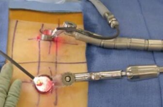 Minimally Invasive Spine Surgery India: Meet the Top Spine Surgeon in Kolkata