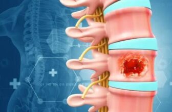 Spine Tumor Surgery in India: Meet the Top Spine Specialist in India