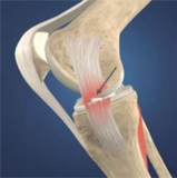 Advanced Imaging in Orthopaedics Knee Rehabilitation