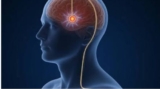 DBS for Advanced Parkinsons’ Disease: Brain Pacemaker Surgery by Expert DBS Surgeon