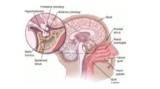 Decoding Brain Tumors: A Guide to Pituitary Tumors in Kolkata