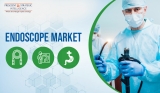 Endoscope Market Analysis, Top Companies, New Technology, Demand and Opportunity Analysis