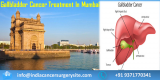Get Affordable Gallbladder Cancer Treatment in Mumbai