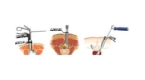 Kolkata’s Top Spine Surgeons: Expertise in Minimal Access Spine Surgery for Optimal Results