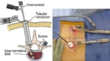 Meet a Minimally Invasive Spine Surgeon in India: Top Spine Surgeon in Kolkata