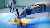 The impact of COVID-19 on Orthopedic Surgical Robots Market 2020 Driving Factors, Industry Growth, Key Vendors and Forecasts to 2025