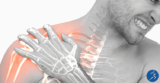What to Expect After Your Shoulder Arthroscopy and Rotator Cuff Repair