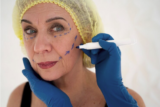 Lifting without Limits: Exploring the Magic of Non-Surgical Facelifts