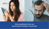 Microneedling for Hair Loss: Examining the Reality in Oceanside