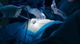 Top Spine Surgeon India: Expert Minimal Access & Minimally Invasive Care