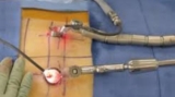 Top Spine Surgeon India: Quick Recovery After Minimally Invasive Spine Surgery