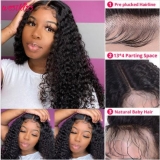 6 common types of hair loss